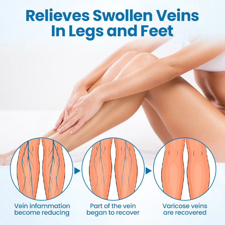 Ourlyard® VeinGuard Herbal Spray-✅ Clinically proven to eliminate varicose veins in just 7 days!