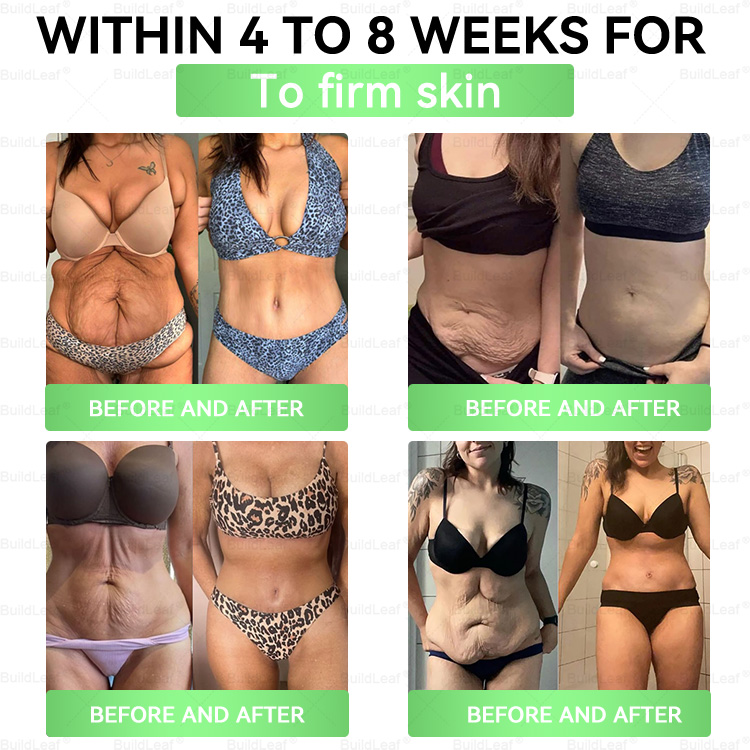 CVS Online | 𝘽𝙪𝙞𝙡𝙙𝙇𝙚𝙖𝙛® 𝗚𝗟𝗣-𝟭 𝟖-𝗶𝗻-𝟭 𝗦𝗹𝗶𝗺 & 𝑯𝒆𝒂𝒍𝒕𝒉𝐲 𝑶𝒓𝒂𝒍 𝑺𝒐𝒍𝒖𝒕𝒊𝒐𝒏 𝑂𝑛𝑐𝑒 𝑎 𝑑𝑎𝑦, 𝑣𝑖𝑠𝑖𝑏𝑙𝑒 𝑟𝑒𝑠𝑢𝑙𝑡𝑠 𝑖𝑛 7 𝑑𝑎𝑦𝑠  ✅ 𝗦𝘂𝗽𝗽𝗼𝗿𝘁𝘀 𝗼𝗯𝗲𝘀𝗶𝘁𝘆, 𝗰𝗮𝗿𝗱𝗶𝗼𝘃𝗮𝘀𝗰𝘂𝗹𝗮𝗿 𝗵𝗲𝗮𝗹𝘁𝗵, 𝗱𝗶𝗮𝗯𝗲𝘁𝗲𝘀, 𝘀𝗹𝗲𝗲𝗽 𝗮𝗽𝗻𝗲𝗮, 𝗴𝘂𝘁 𝗵𝗲𝗮𝗹𝘁𝗵, 𝗷𝗼𝗶𝗻𝘁 𝗶𝘀𝘀𝘂𝗲𝘀, 𝐰𝐡𝐢𝐥𝐞 𝐚𝐥𝐬𝐨 𝐟𝐢𝐫𝐦𝐢𝐧𝐠 𝐭𝐡𝐞 𝐬𝐤𝐢𝐧 𝐚𝐧𝐝 𝐛𝐨𝐨𝐬𝐭𝐢𝐧𝐠 𝐞𝐧𝐞𝐫𝐠𝐲.