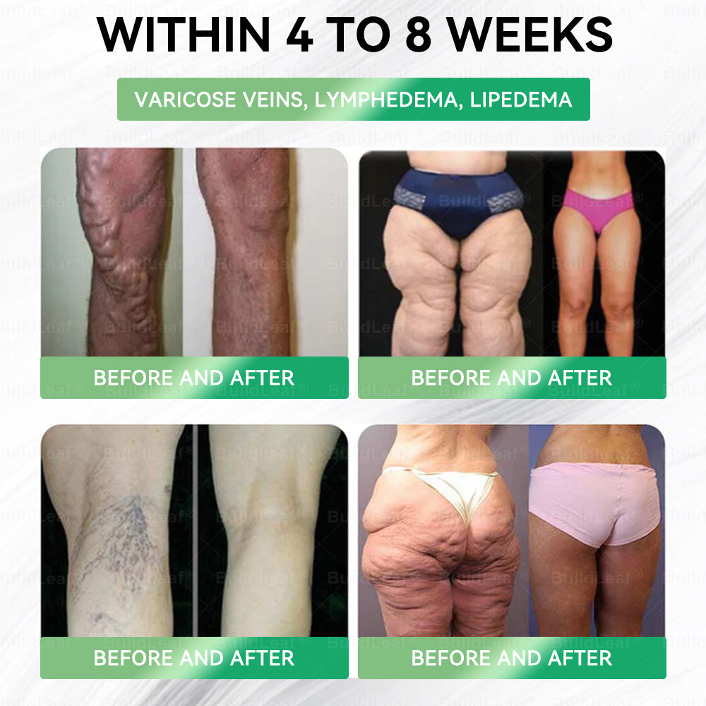 CVS Online | 𝘽𝙪𝙞𝙡𝙙𝙇𝙚𝙖𝙛® 𝗚𝗟𝗣-𝟭 𝟖-𝗶𝗻-𝟭 𝗦𝗹𝗶𝗺 & 𝑯𝒆𝒂𝒍𝒕𝒉𝐲 𝑶𝒓𝒂𝒍 𝑺𝒐𝒍𝒖𝒕𝒊𝒐𝒏 𝑂𝑛𝑐𝑒 𝑎 𝑑𝑎𝑦, 𝑣𝑖𝑠𝑖𝑏𝑙𝑒 𝑟𝑒𝑠𝑢𝑙𝑡𝑠 𝑖𝑛 7 𝑑𝑎𝑦𝑠  ✅ 𝗦𝘂𝗽𝗽𝗼𝗿𝘁𝘀 𝗼𝗯𝗲𝘀𝗶𝘁𝘆, 𝗰𝗮𝗿𝗱𝗶𝗼𝘃𝗮𝘀𝗰𝘂𝗹𝗮𝗿 𝗵𝗲𝗮𝗹𝘁𝗵, 𝗱𝗶𝗮𝗯𝗲𝘁𝗲𝘀, 𝘀𝗹𝗲𝗲𝗽 𝗮𝗽𝗻𝗲𝗮, 𝗴𝘂𝘁 𝗵𝗲𝗮𝗹𝘁𝗵, 𝗷𝗼𝗶𝗻𝘁 𝗶𝘀𝘀𝘂𝗲𝘀, 𝐰𝐡𝐢𝐥𝐞 𝐚𝐥𝐬𝐨 𝐟𝐢𝐫𝐦𝐢𝐧𝐠 𝐭𝐡𝐞 𝐬𝐤𝐢𝐧 𝐚𝐧𝐝 𝐛𝐨𝐨𝐬𝐭𝐢𝐧𝐠 𝐞𝐧𝐞𝐫𝐠𝐲.