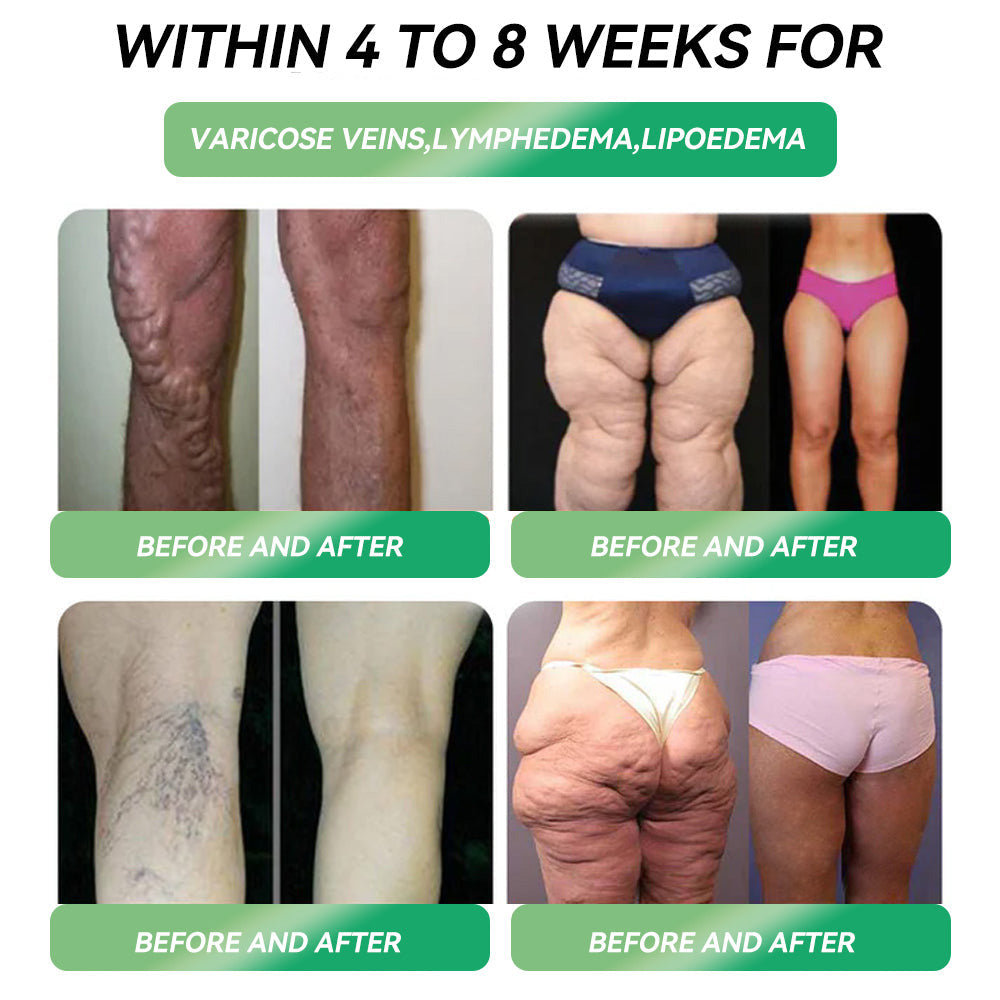 💪🔥𝙕𝙫𝙤𝙚𝙫𝙤®  GL𝐏-1 8-𝒊𝒏-1 𝙁𝙞𝙩 & 𝙑𝙞𝙩𝙖𝙡 𝖮𝗋𝖺𝗅 𝙎𝙤𝙡𝙪𝙩𝙞𝙤𝙣  (𝑱𝒖𝒔𝒕 𝒐𝒏𝒄𝒆 𝒂 𝒅𝒂𝒚, 𝒗𝒊𝒔𝒊𝒃𝒍𝒆 𝒄𝒉𝒂𝒏𝒈𝒆𝒔 𝒊𝒏 7 𝒅𝒂𝒚𝒔) 👨‍⚕️ 𝑻𝒂𝒓𝒈𝒆𝒕𝒔 𝒐𝒃𝒆𝒔𝒊𝒕𝒚, 𝒄𝒂𝒓𝒅𝒊𝒐𝒗𝒂𝒔𝒄𝒖𝒍𝒂𝒓 𝒉𝒆𝒂𝒍𝒕𝒉, 𝒅𝒊𝒂𝒃𝒆𝒕𝒆𝒔, 𝒔𝒍𝒆𝒆𝒑 𝒂𝒑𝒏𝒆𝒂, 𝒈𝒖𝒕 𝒉𝒆𝒂𝒍𝒕𝒉, 𝒋𝒐𝒊𝒏𝒕 𝒊𝒔𝒔𝒖𝒆𝒔 & 𝒎𝒐𝒓𝒆